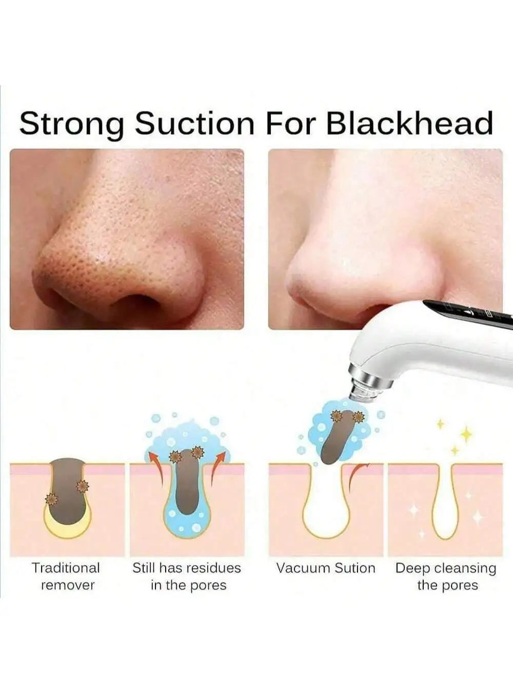 pore vacuum facial cleaner, blackhead remover,