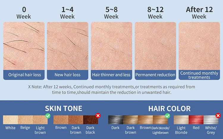 Mlay T18 ICE Cooling Hair Removal Device  IPL Laser For Women Men